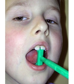 a boy using tongue tip elevation tool