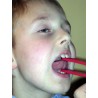 A boy using Talk Tools jaw exerciser